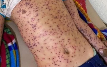 ಜೇನುಹುಳಗಳ ದಾಳಿ: ಐವರು ರೈತರು ಗಂಭೀರ ಸ್ಥಿತಿಯಲ್ಲಿ