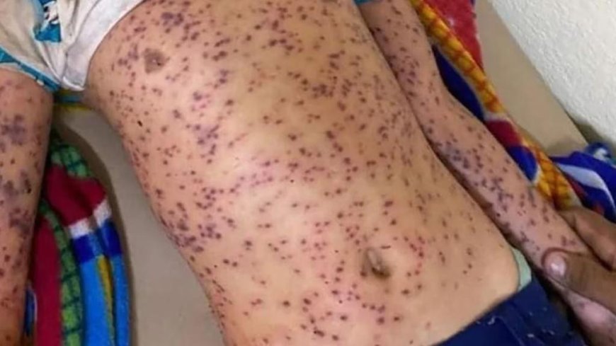 ಜೇನುಹುಳಗಳ ದಾಳಿ: ಐವರು ರೈತರು ಗಂಭೀರ ಸ್ಥಿತಿಯಲ್ಲಿ